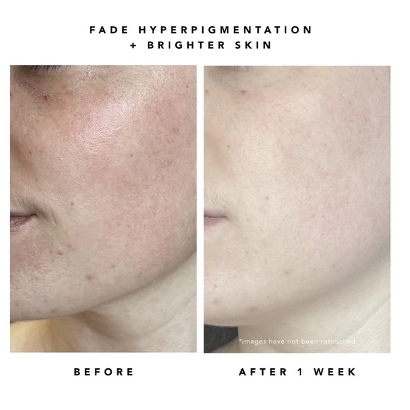 NEW Herbivore Milky Way 10% AHA + Oat Soothing Exfoliating Serum - Picture 5 of 7